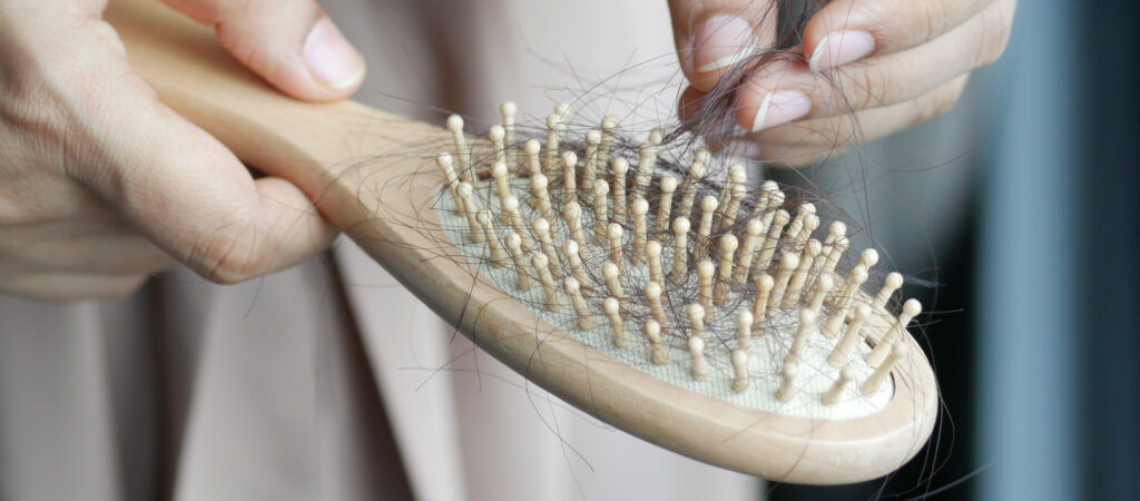 Close-up of hands holding a hairbrush full of hair strands.